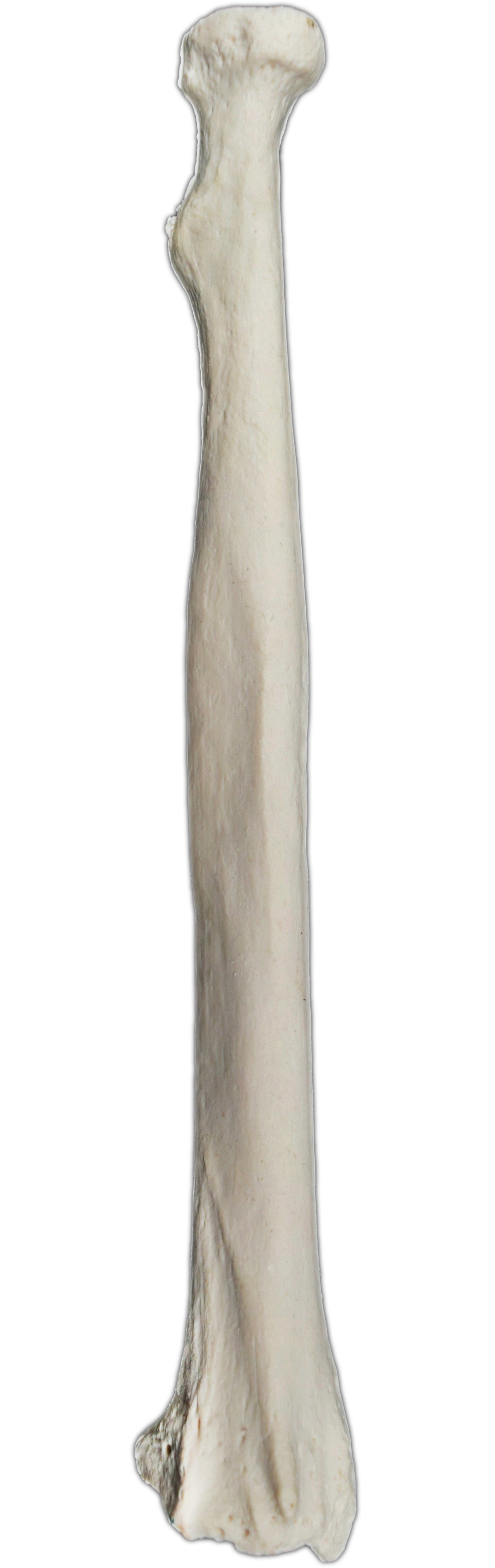 Right Radius Bone Model