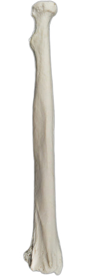 Right Radius Bone Model