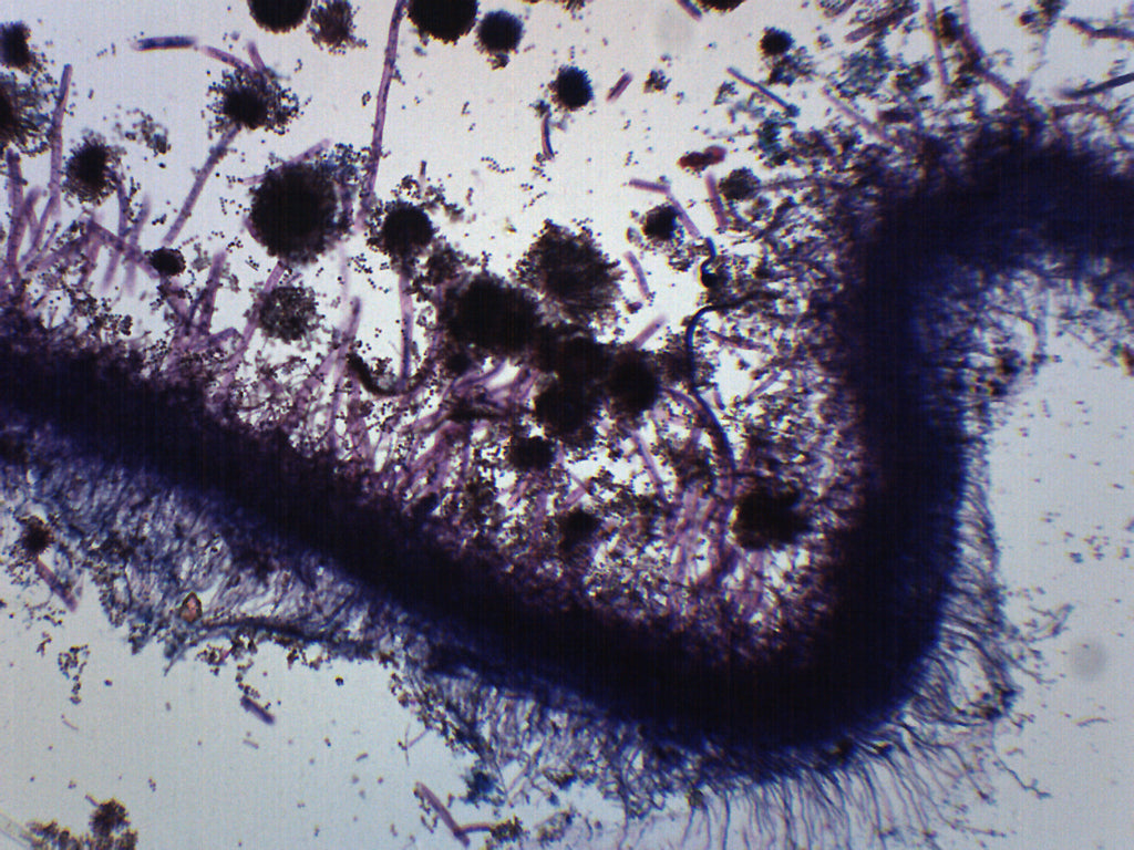 Aspergillus (Brown Mold) Wholemount Prepared Microscope Slide