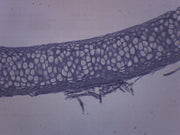 Yellow Elastic Cartilage Prepared Microscope Slide
