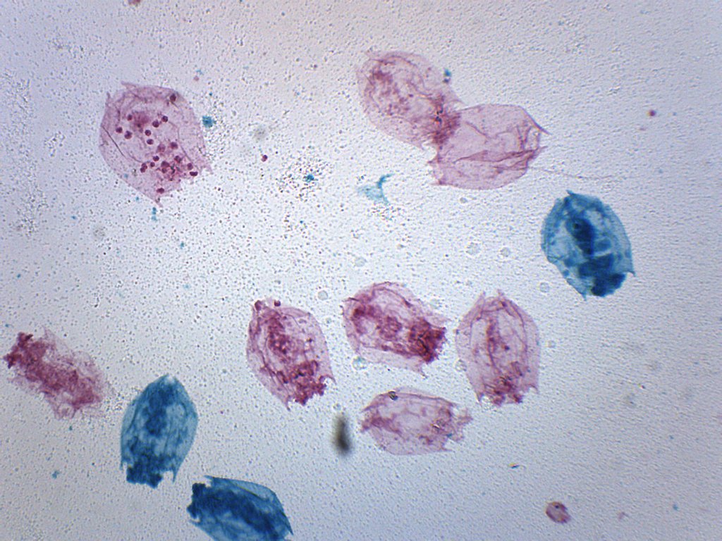 Mixed Freshwater Rotifers Prepared Microscope Slide