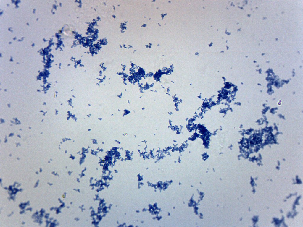 Corynebacterium Diphtheriae Prepared Microscope Slide