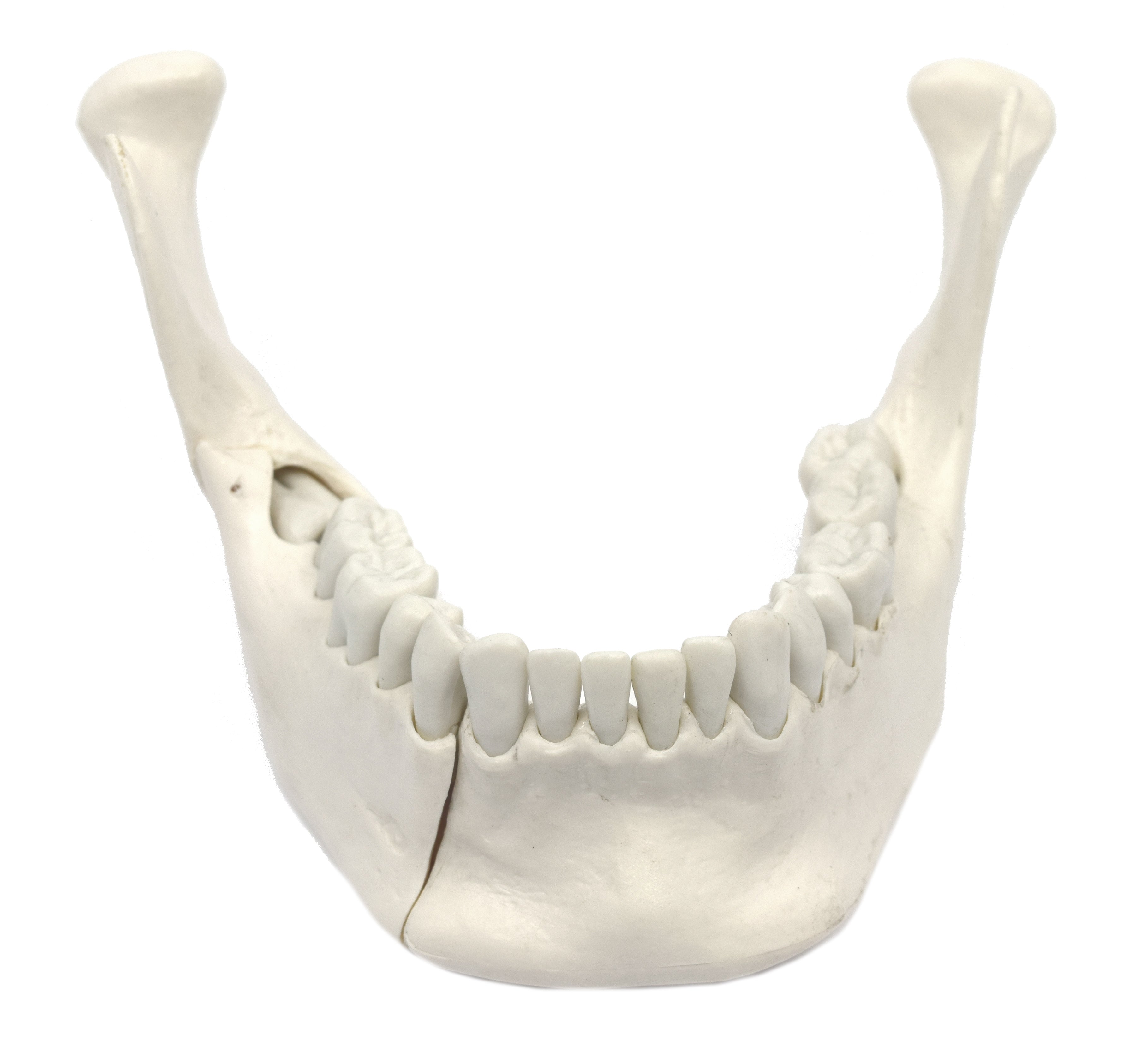 Lower Jaw Model with 16 Extractable Teeth