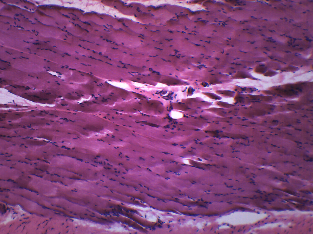 Skeletal Muscle (Mammal) Longitudinal Section Prepared Microscope Slide