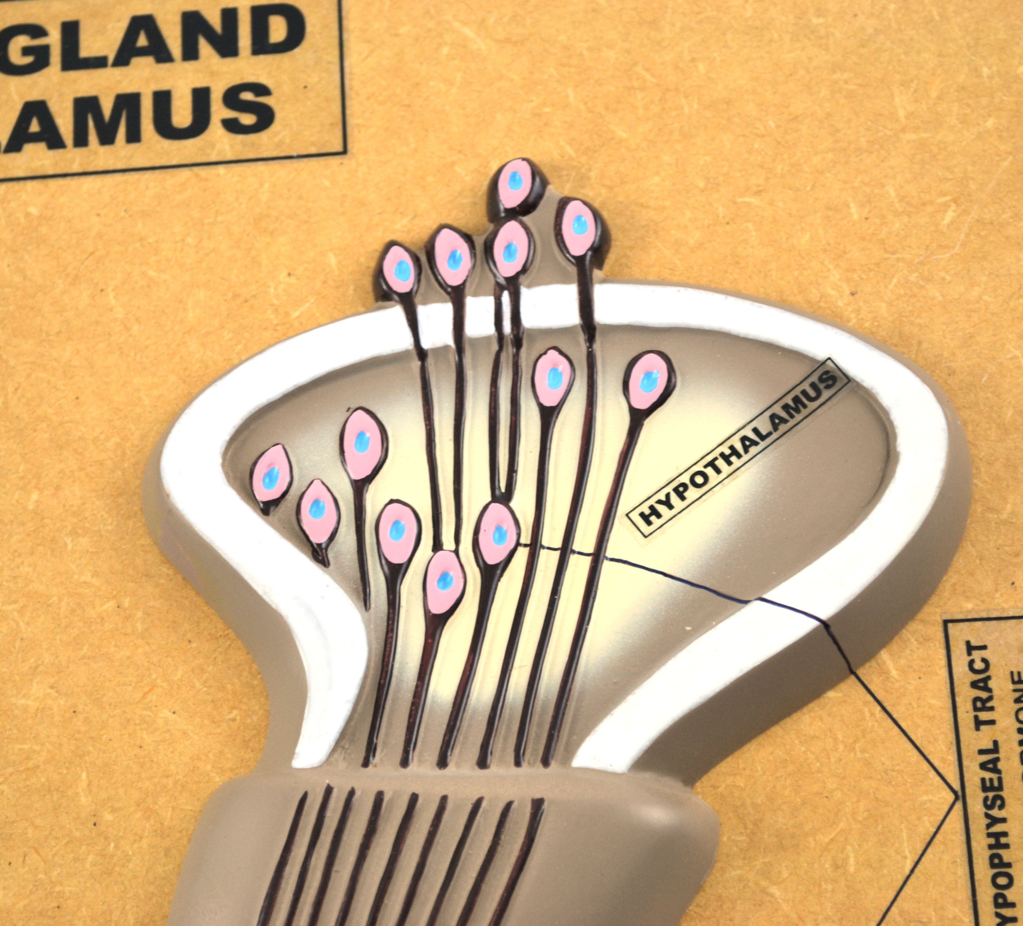 Pituitary Gland and Hypothalamus Model, Greatly Enlarged