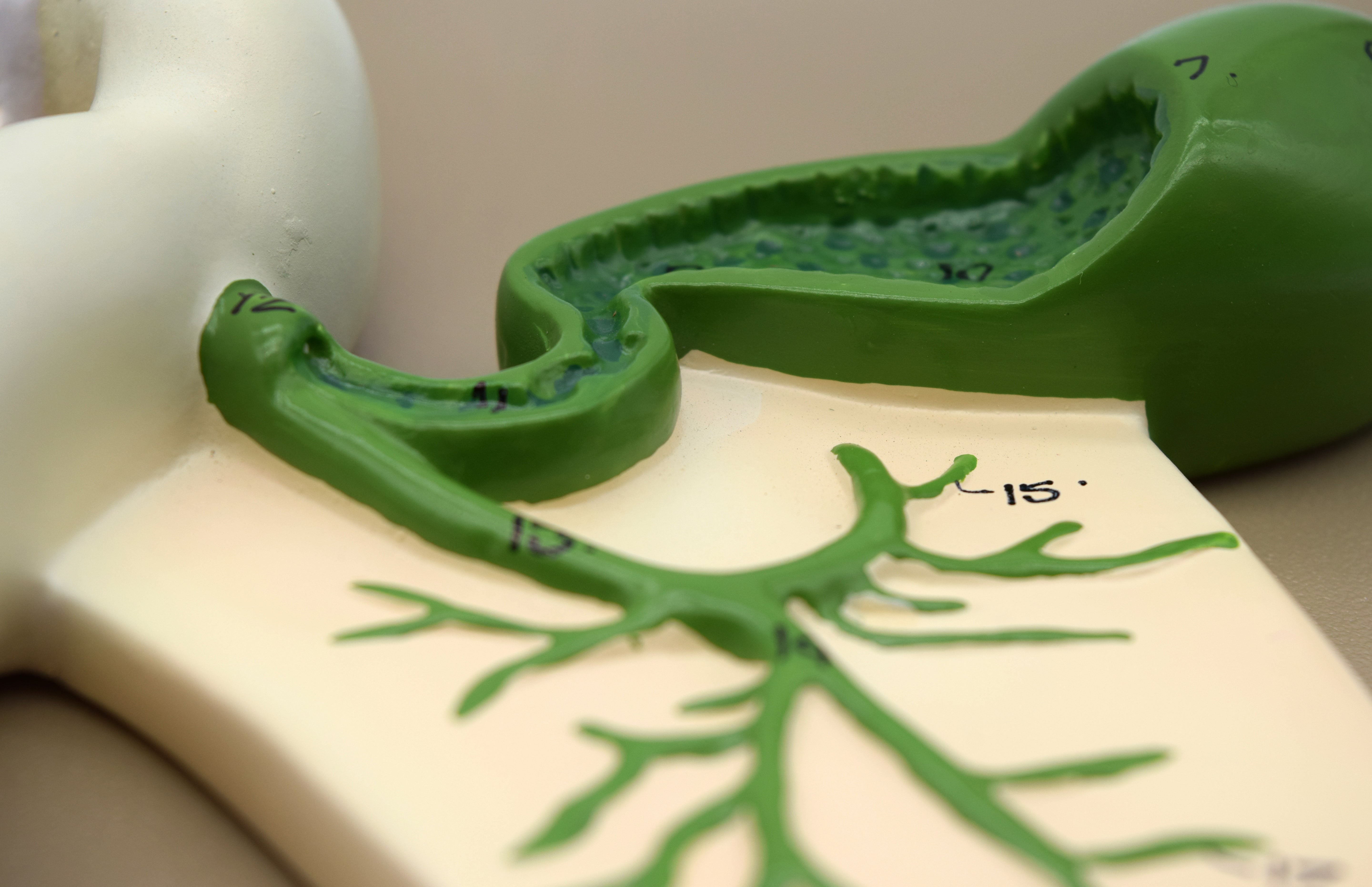 Human Pancreatic Duct Model, 10 x 7" on Base
