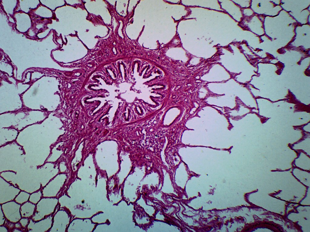 Cat Lung Prepared Microscope Slide