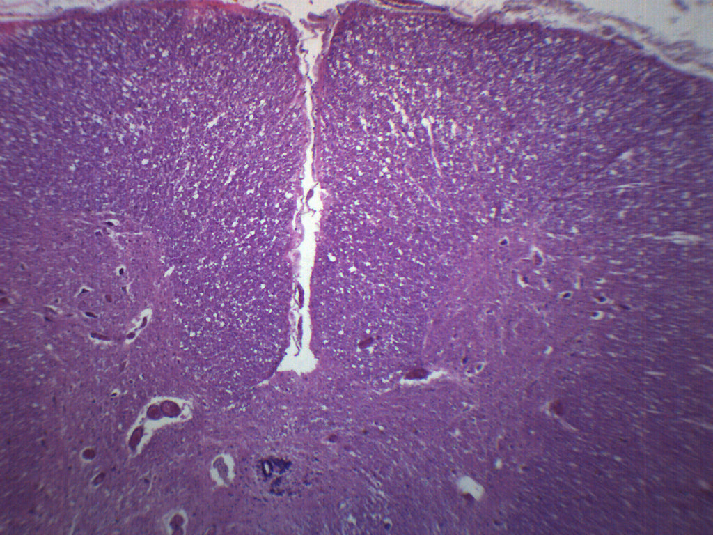 Cervical Spinal Cord (Human) Cross-Section Prepared Microscope Slide