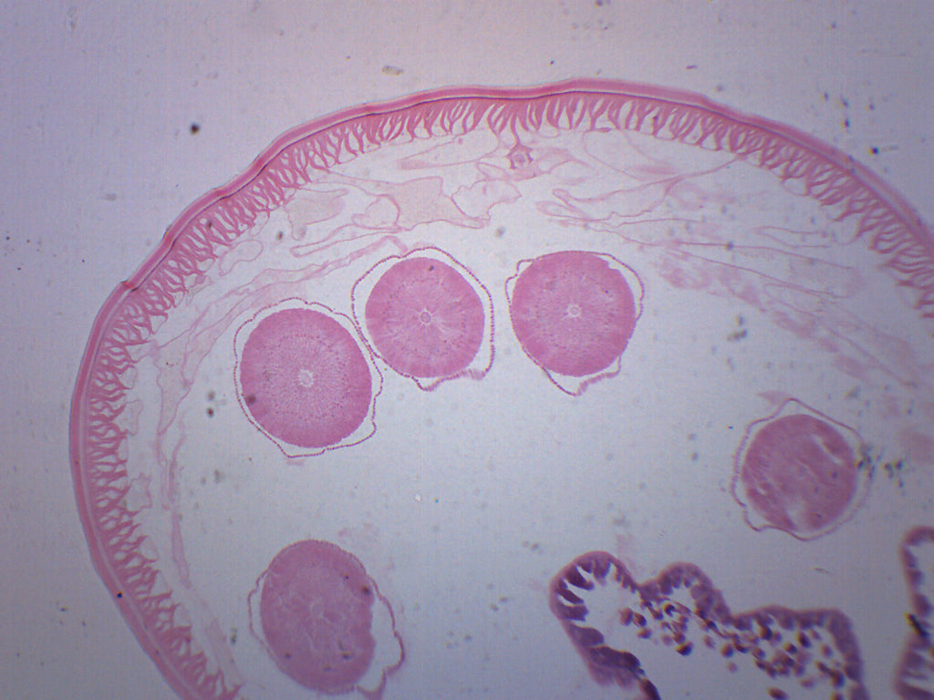 Ascaris Lumbricoides Prepared Microscope Slide