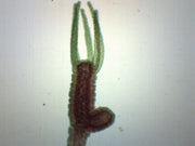 Hydra Bud Wholemount Prepared Microscope Slide