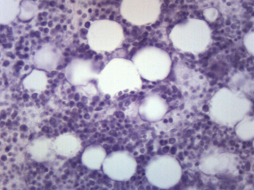 Red Bone Marrow Section (Mammal) Prepared Microscope Slide