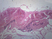 Mammary Gland Section Prepared Microscope Slide