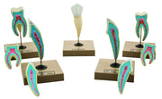 5-Piece Human Teeth Model Set