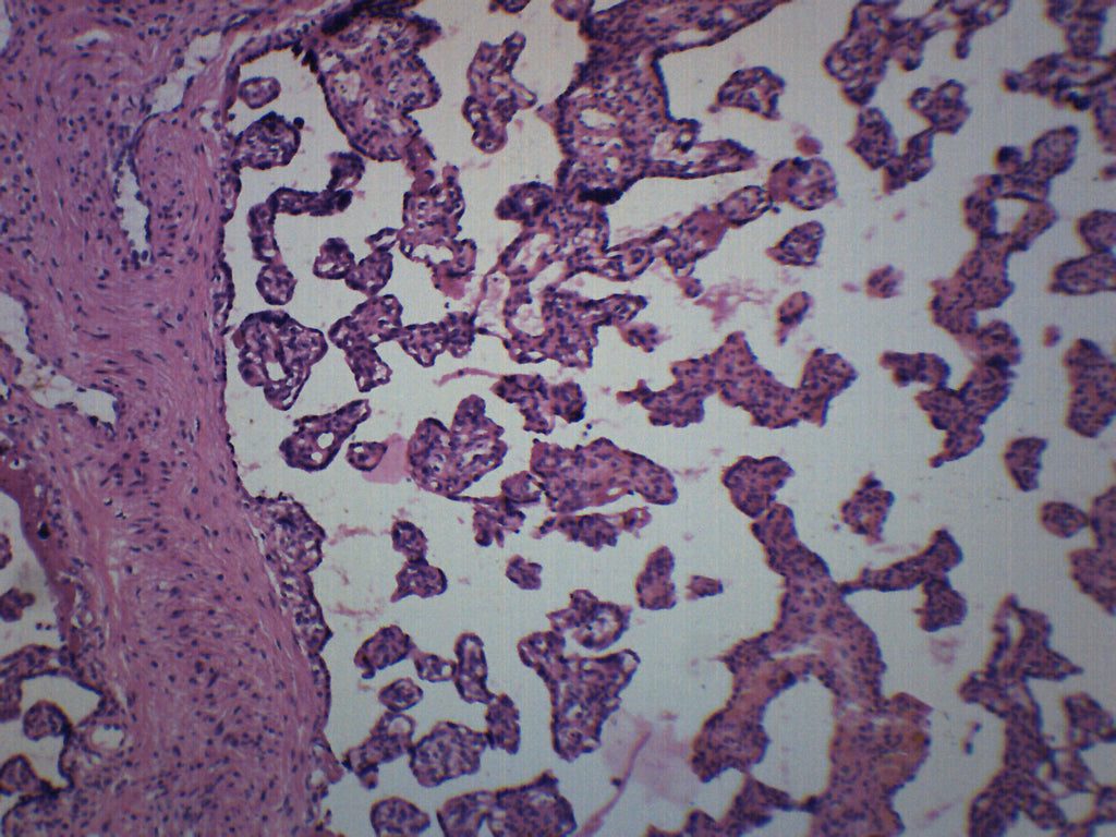 Human Placenta Section Prepared Microscope Slide