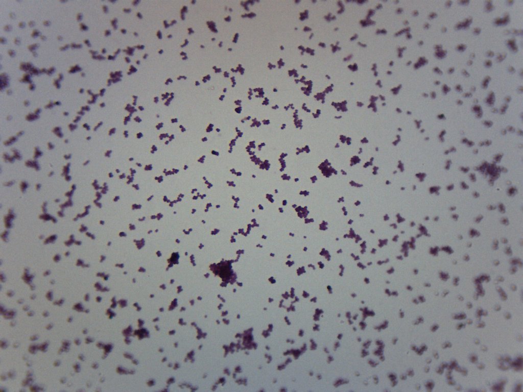 Meningococcus Gram Negative Prepared Microscope Slide