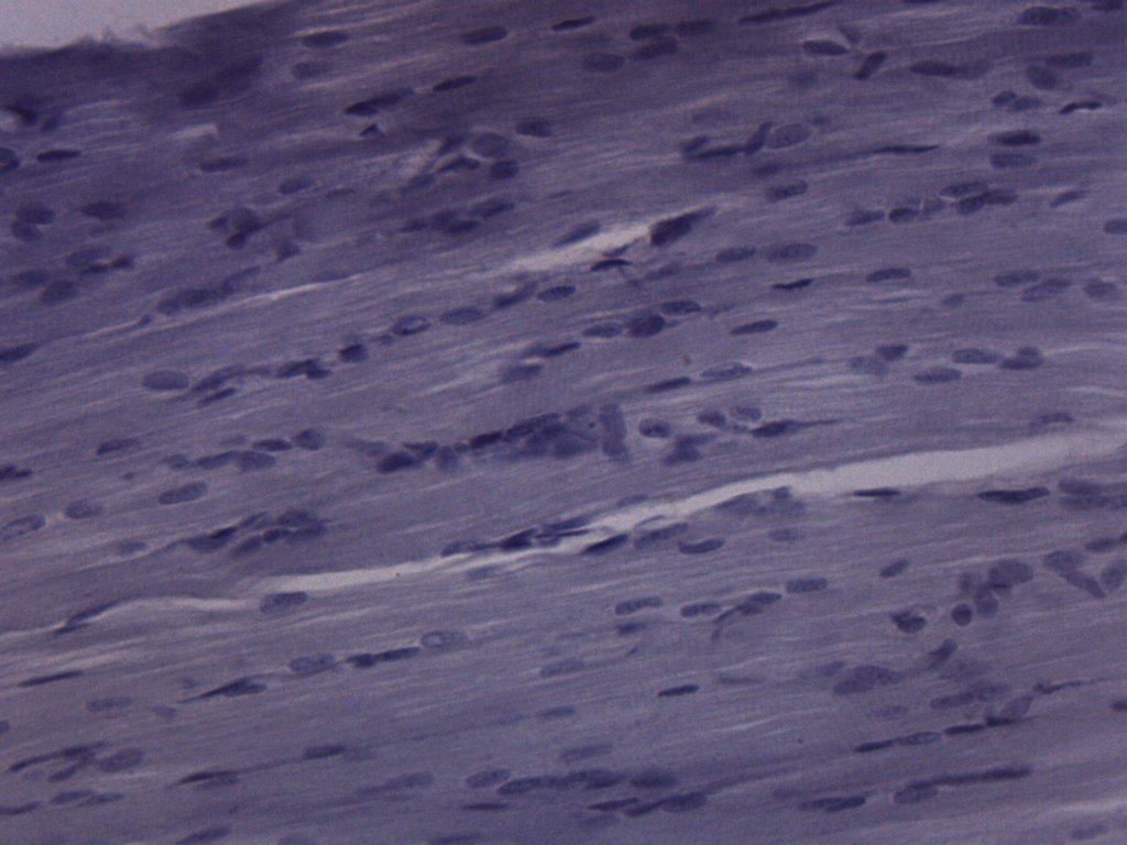 Frog Striated Skeletal Muscle Prepared Microscope Slide