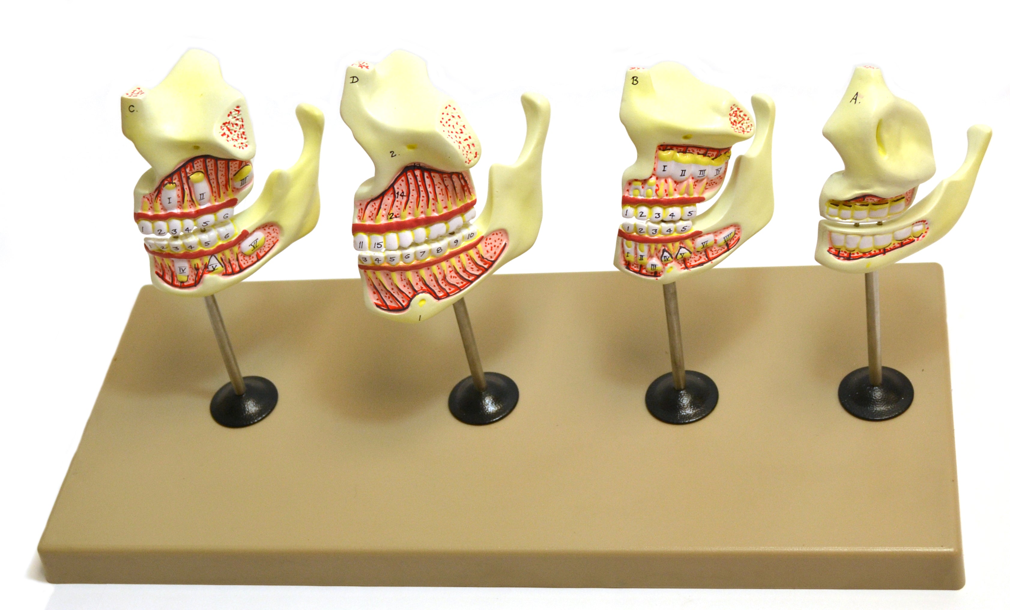 Human Dentition Model, 4 Stages, 8-Piece