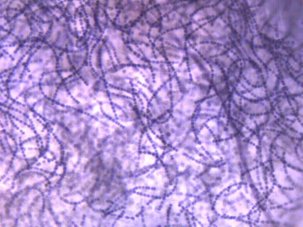 Nostoc Cross-Section with FS and FG Stain Prepared Microscope Slide
