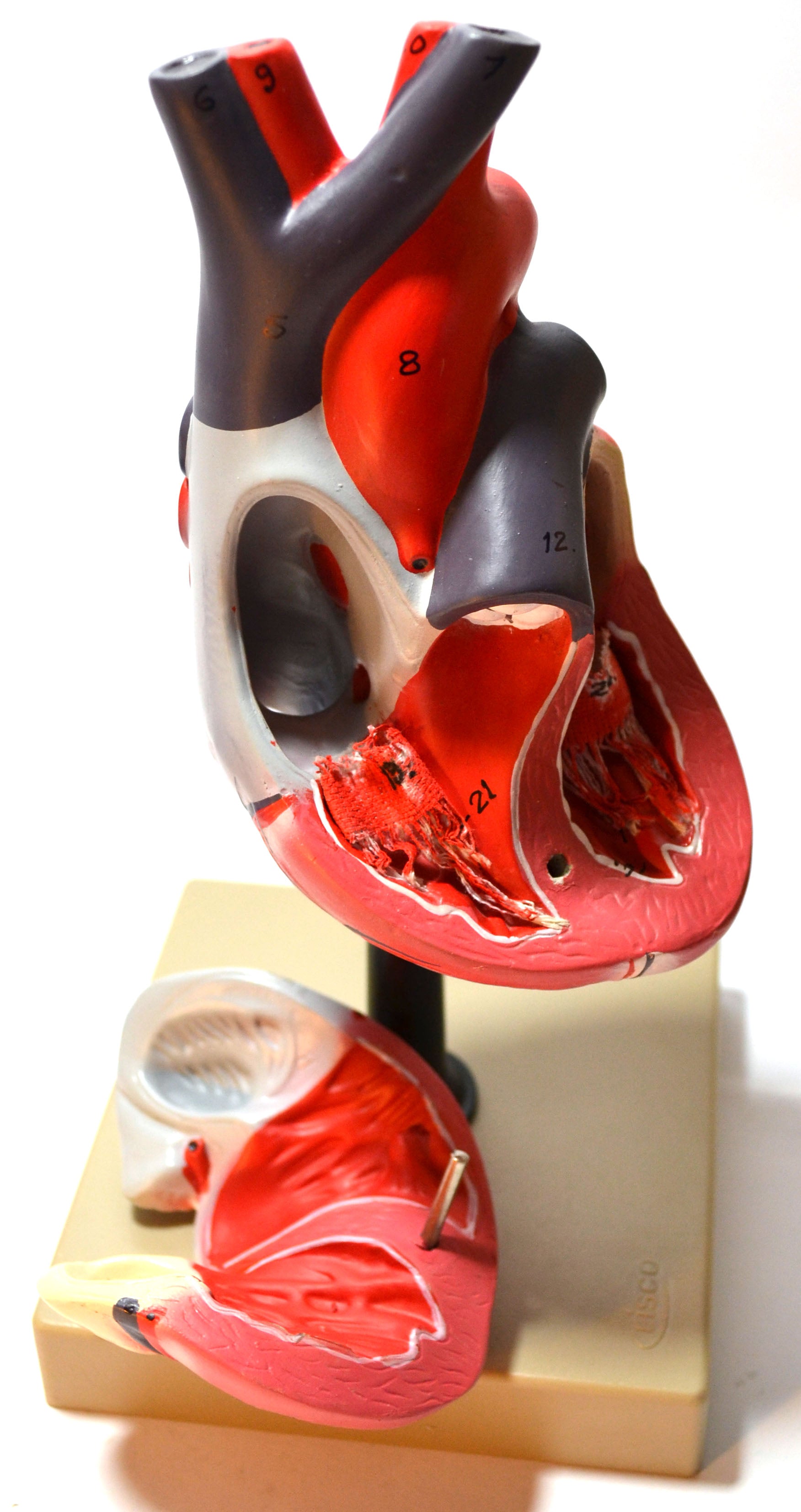 Human Heart Model with Diaphragm, 8" Tall