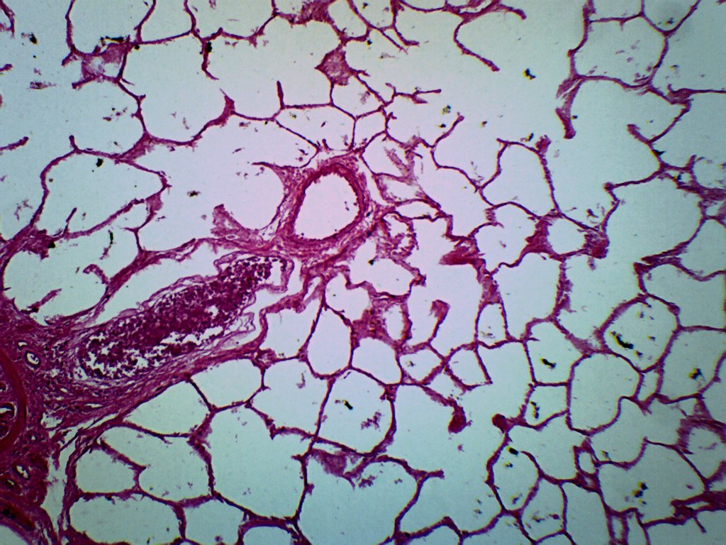 Cat Lung Prepared Microscope Slide