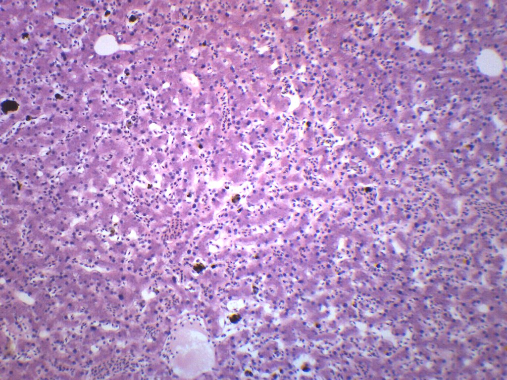 Frog Liver Section Prepared Microscope Slide