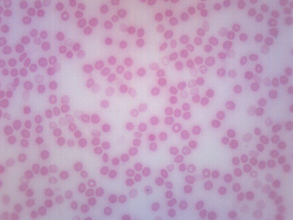 Human Blood Smear Prepared Microscope Slide