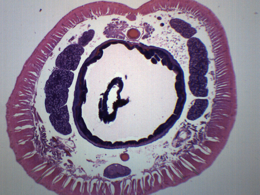 Earthworm Setae Cross-Section Prepared Microscope Slide