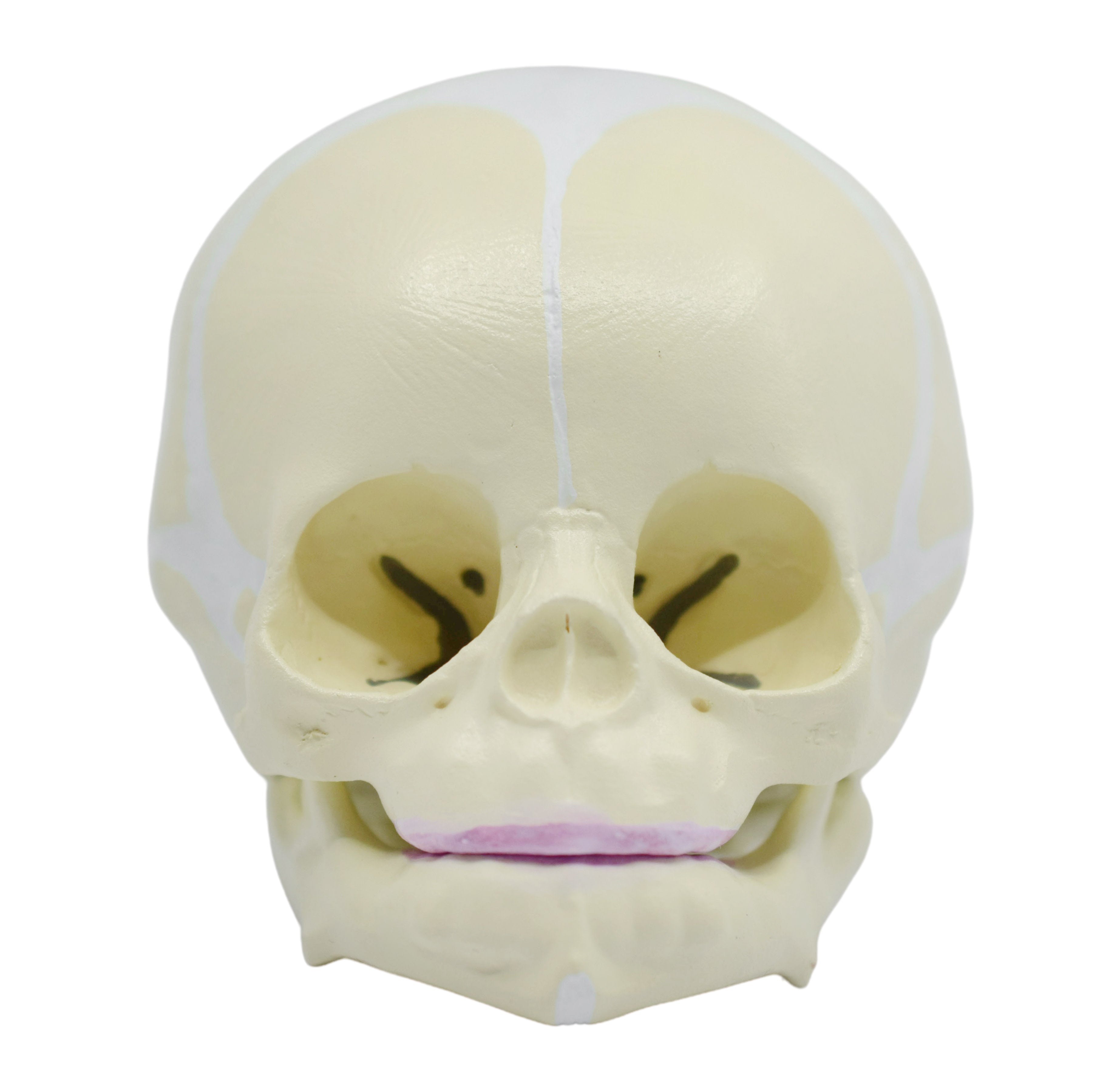 Infant Skull Anatomical Model with Articulated Mandible, Life Size
