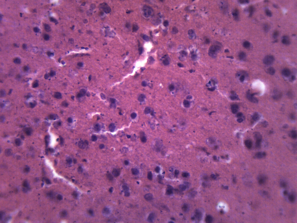 Brain Section (Mammal) Prepared Microscope Slide