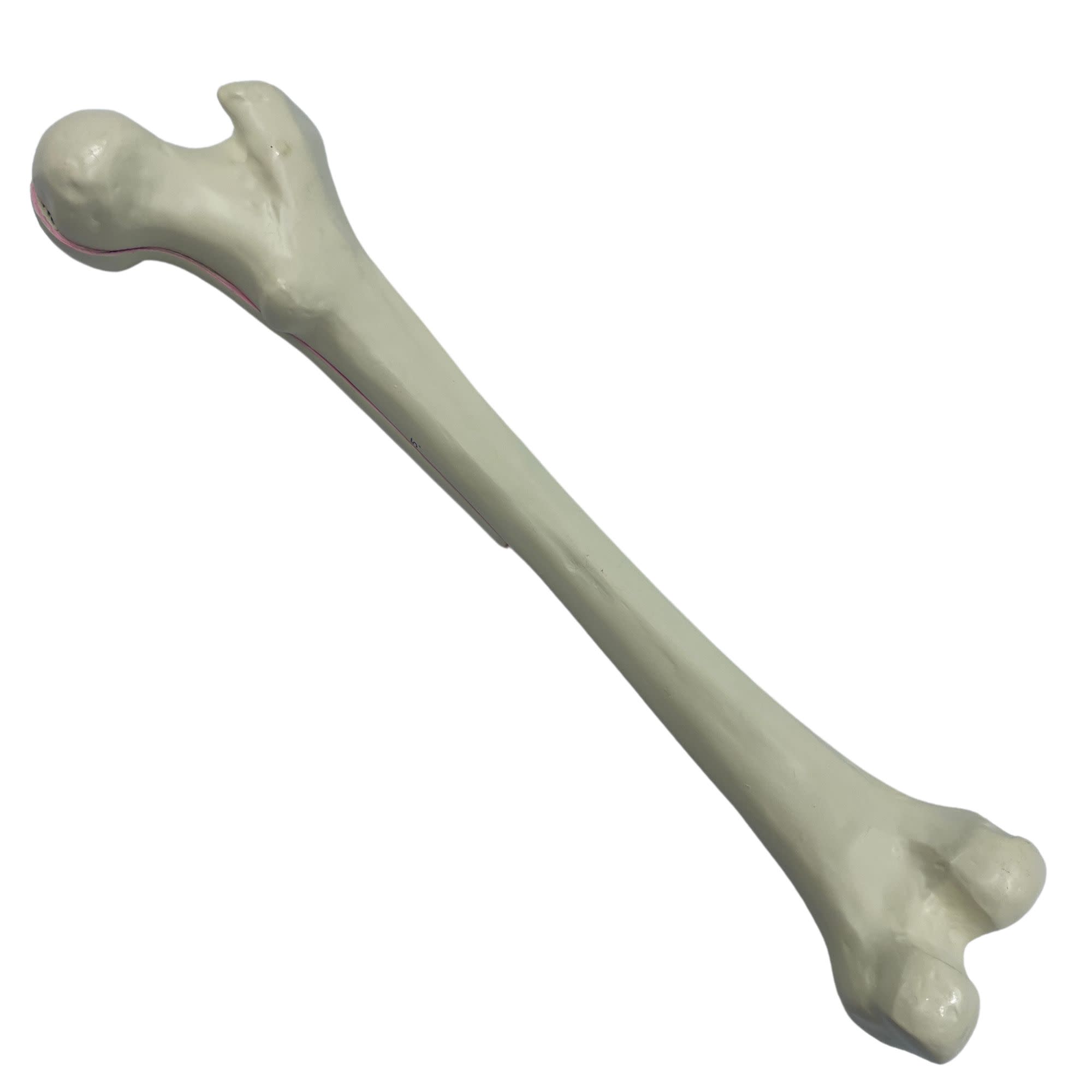 2-Part Human Femur Model with 9 Features