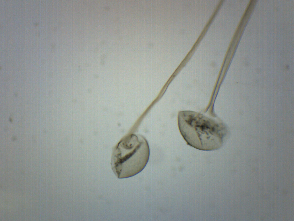 Rhizopus Asexual Reproduction Prepared Microscope Slide