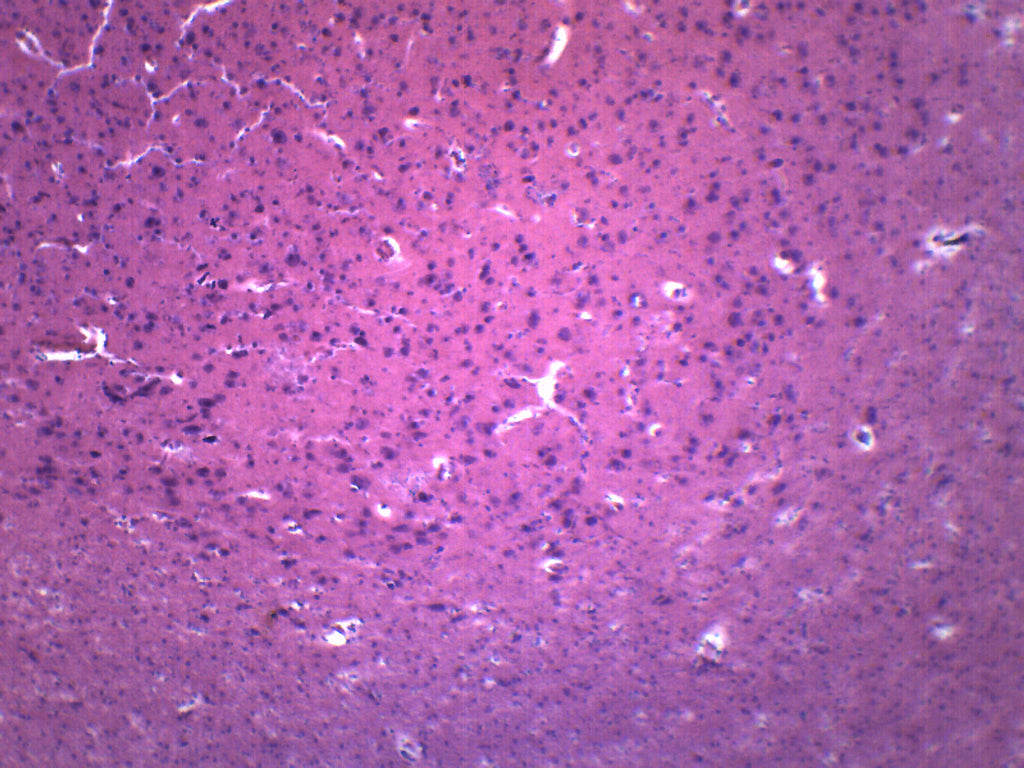 Brain Section (Mammal) Prepared Microscope Slide