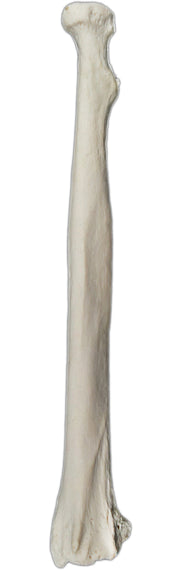 Left Radius Bone Model