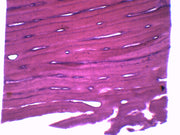 Bone Cross and Longitudinal Section Prepared Microscope Slide
