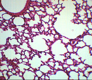 Lung Section Prepared Microscope Slide