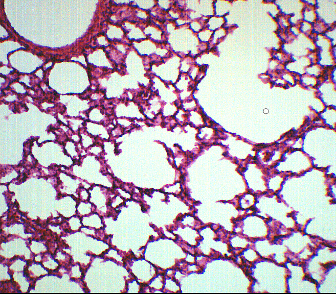 Lung Section Prepared Microscope Slide