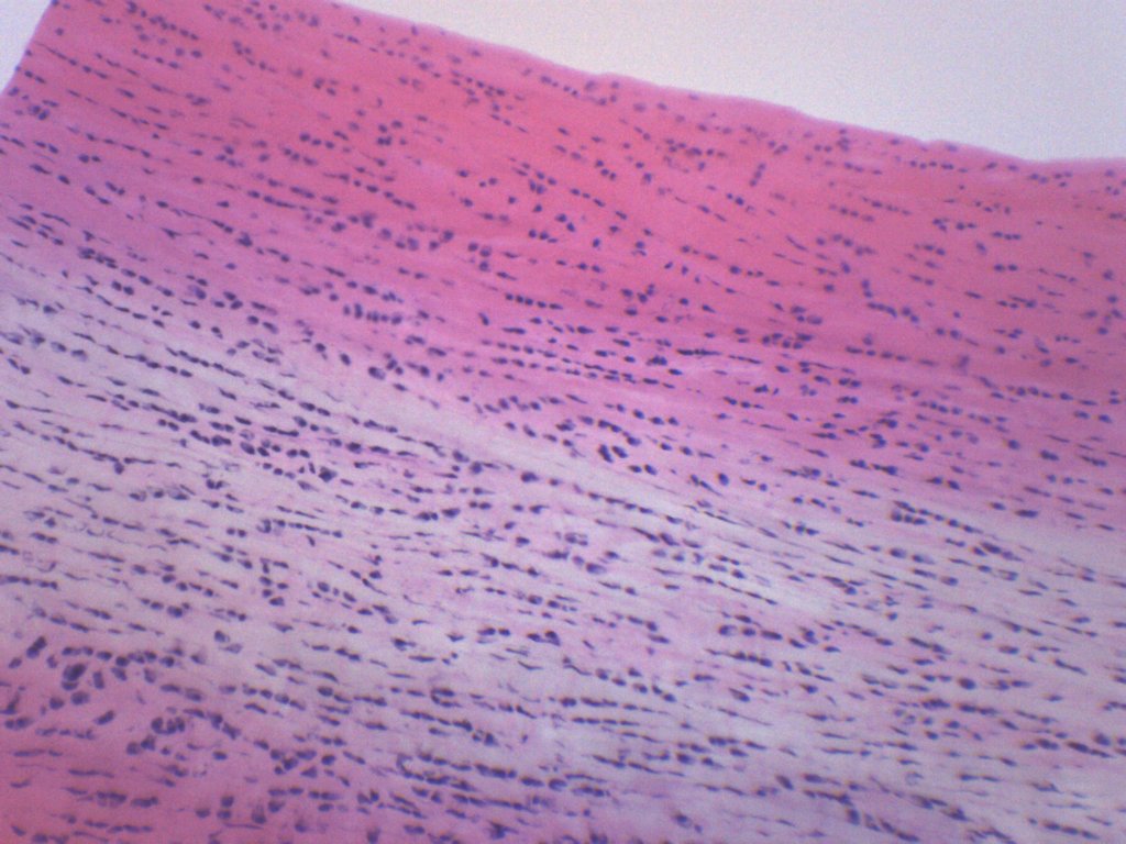 White Fibrocartilage (Mammal) Prepared Microscope Slide