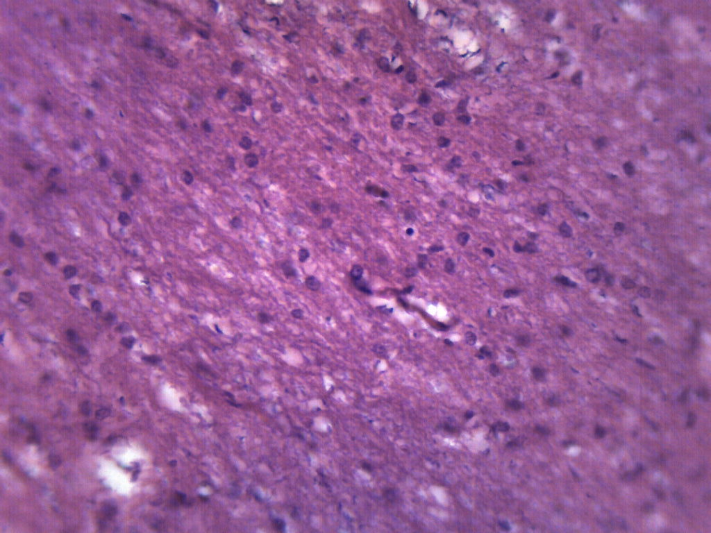 Brain Section (Mammal) Prepared Microscope Slide