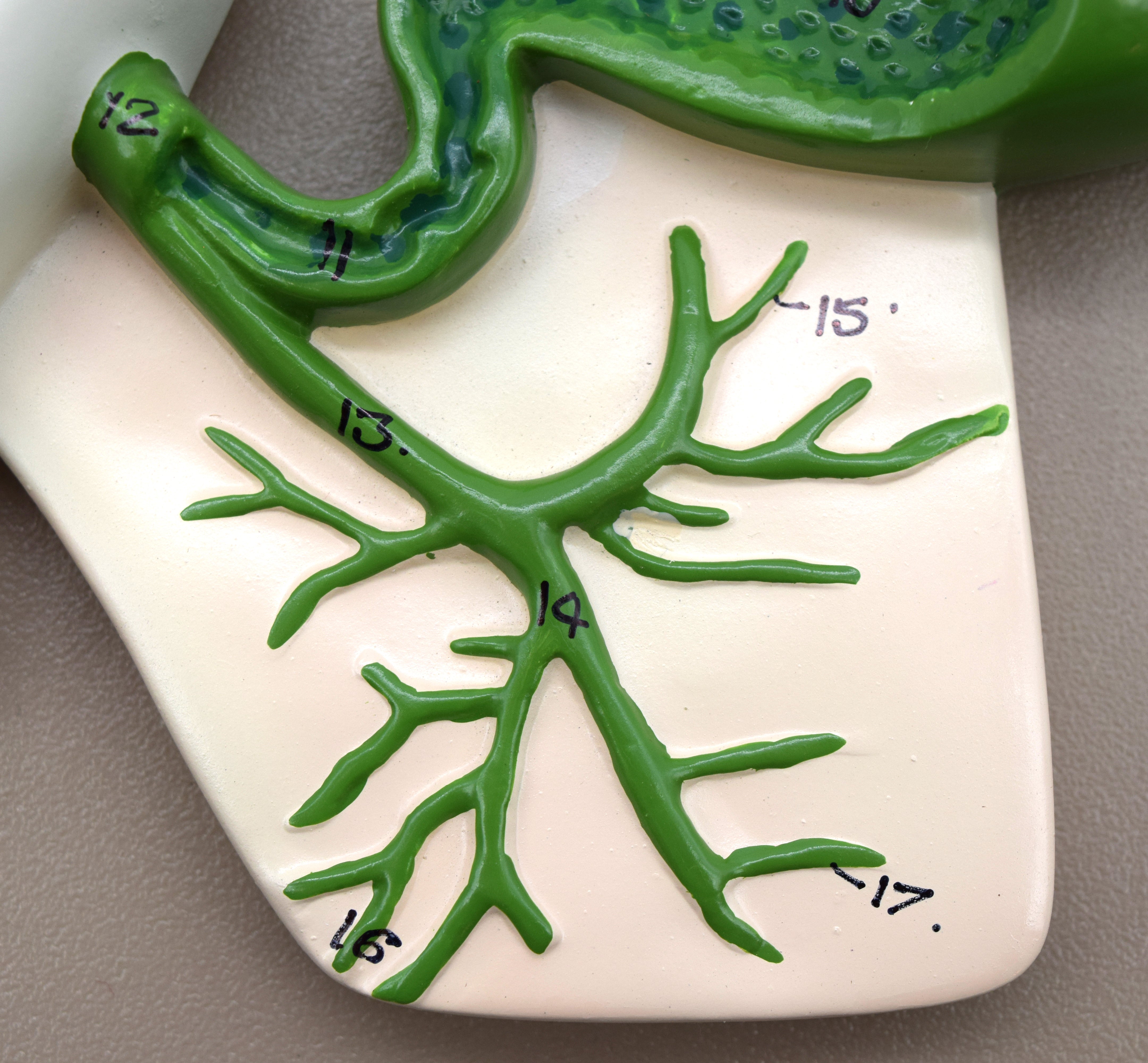 Human Pancreatic Duct Model, 10 x 7" on Base