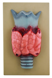 Thyroid Gland Model