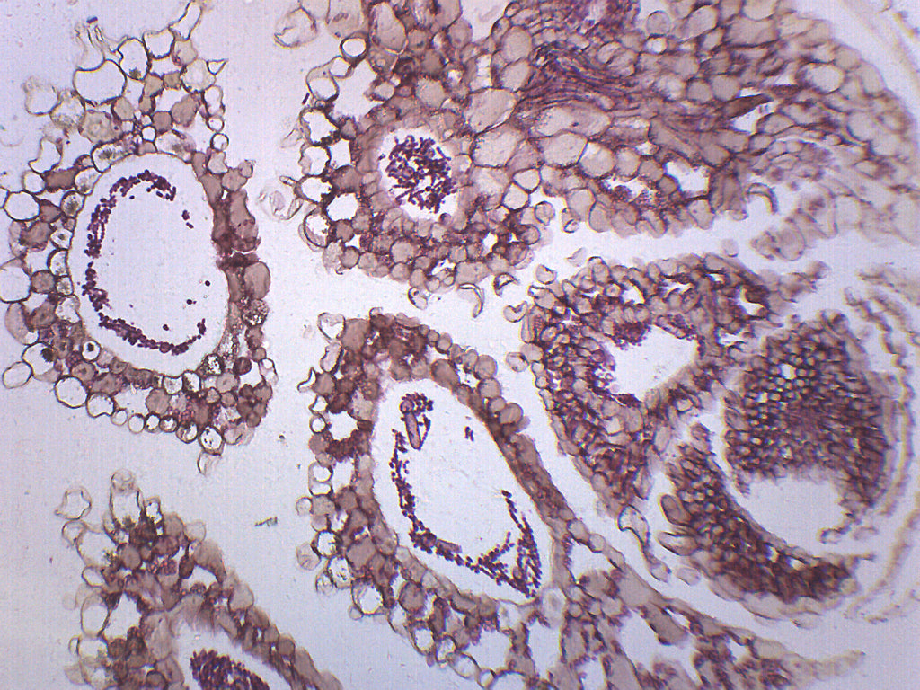 Anabaena Whole Mount Prepared Microscope Slide