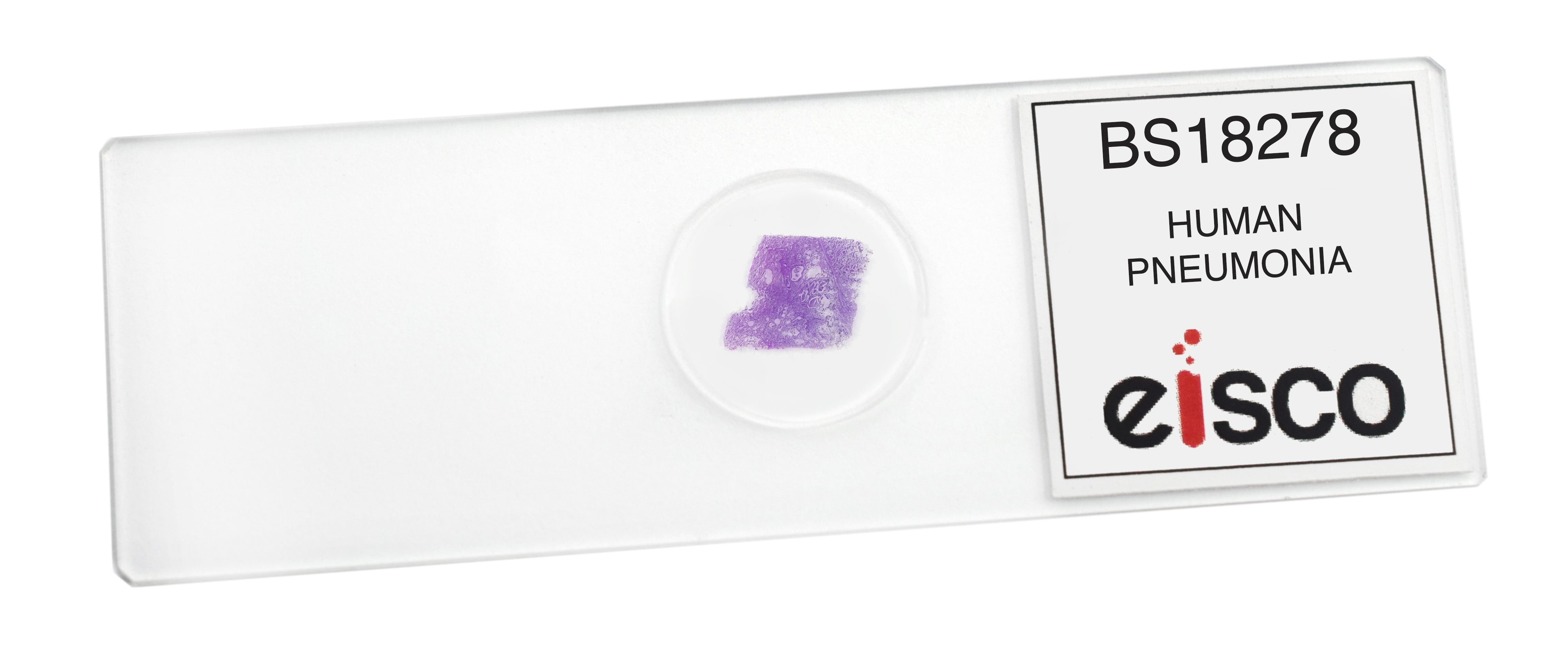 Pneumonia in Human Lungs Prepared Microscope Slide