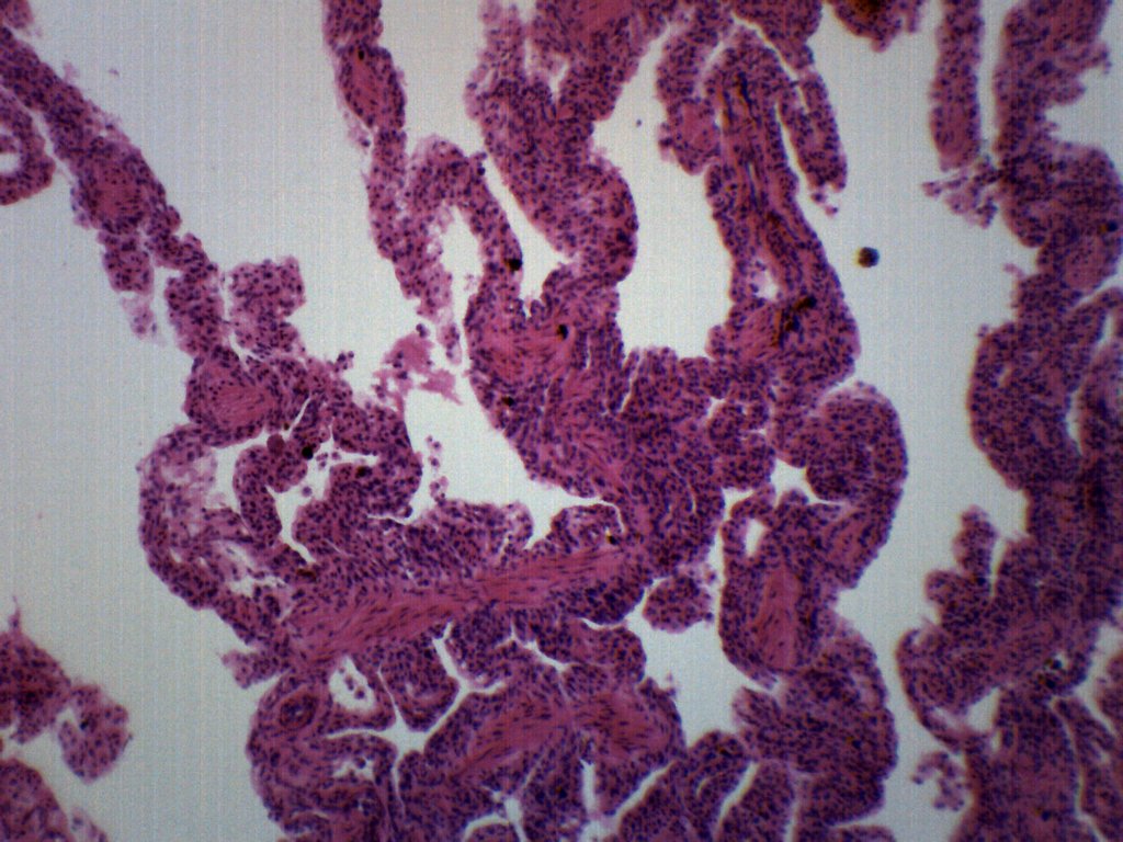 Frog Lung Section Prepared Microscope Slide