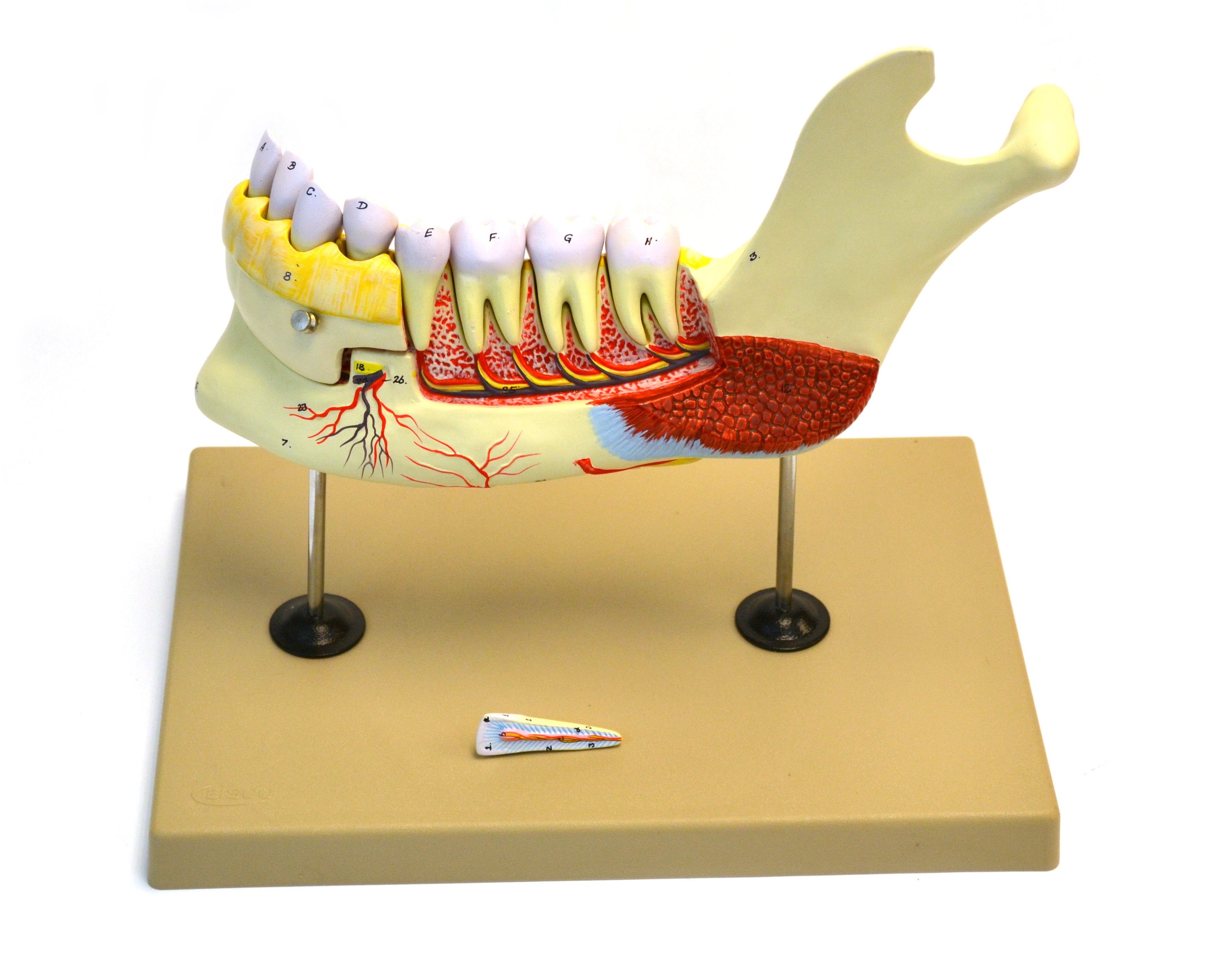 Lower Human Jaw Model, 5X Life Size