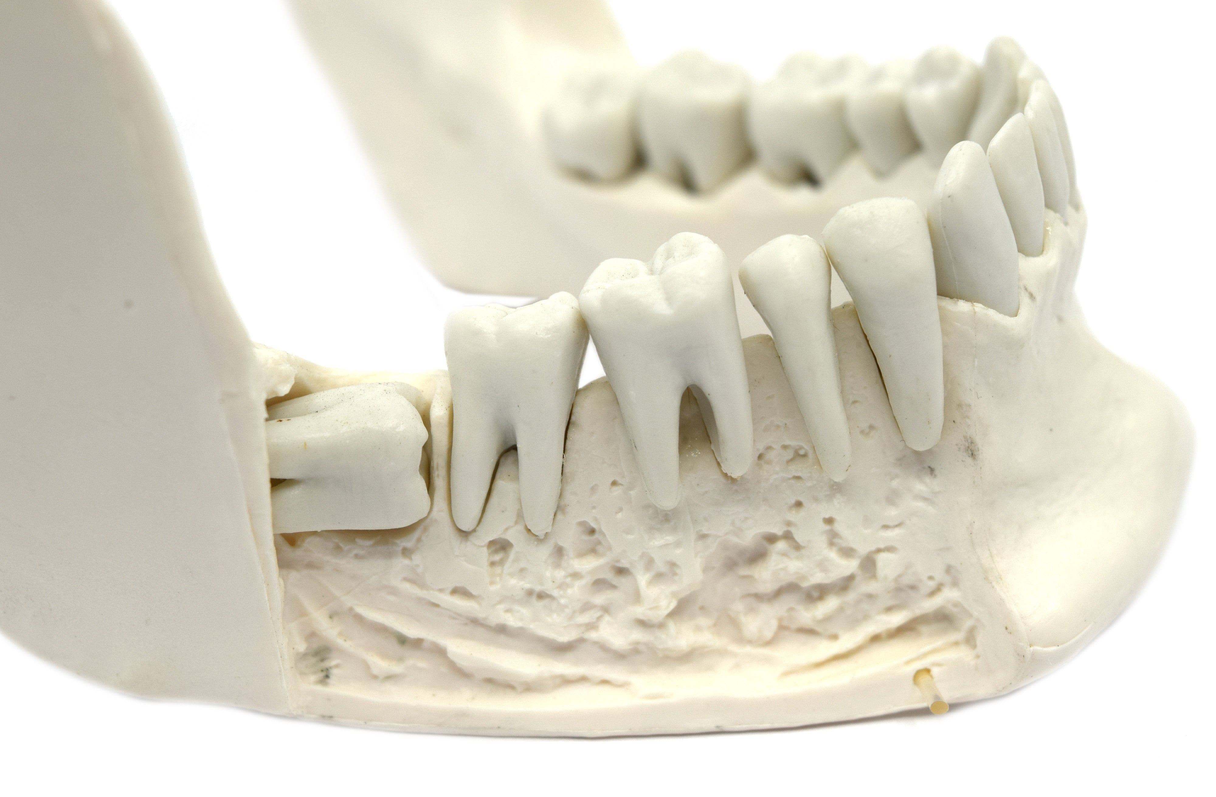 Lower Jaw Model with 16 Extractable Teeth