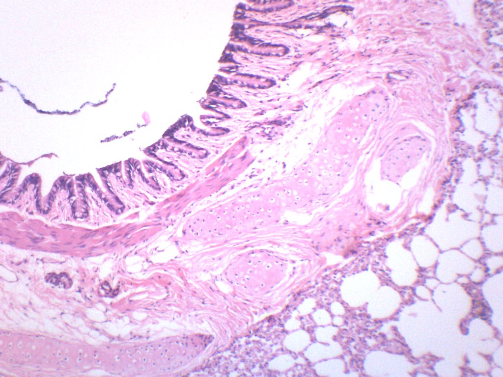 Human Lung Section Prepared Microscope Slide