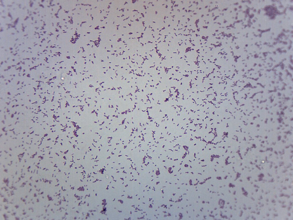 Shigella Dysenteriae Wholemount Prepared Microscope Slide