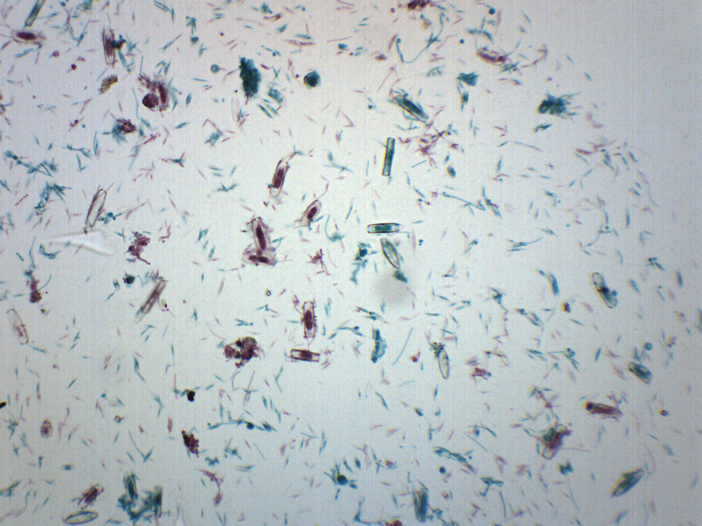 Mixed Diatoms with Fungi Wholemount Prepared Microscope Slide