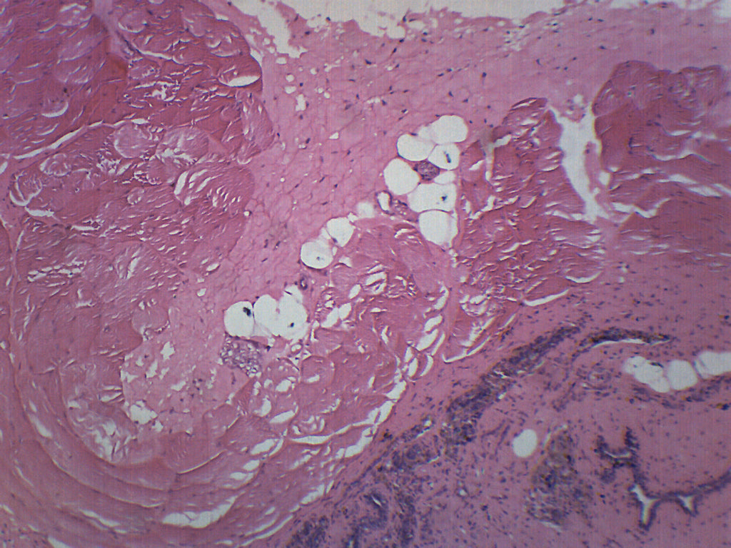Mammary Gland Section Prepared Microscope Slide