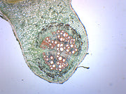 Legume Root Nodule Prepared Microscope Slide